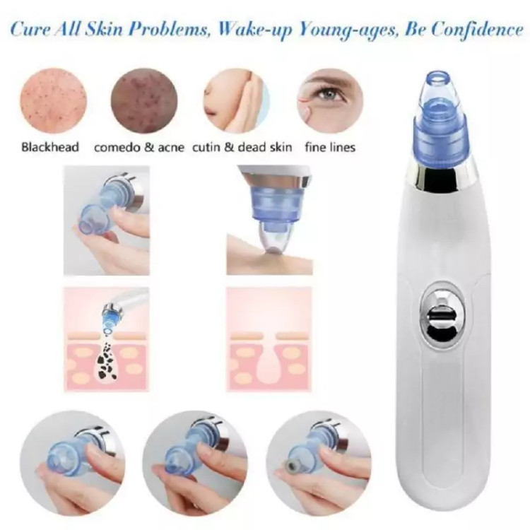دستگاه میکرودرم آبریژن خانگی(DERMASUCTION)