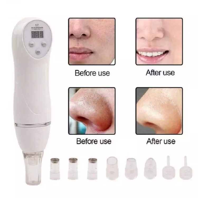 دستگاه میکرودرم دیاموند DIAMOND PEELING-17