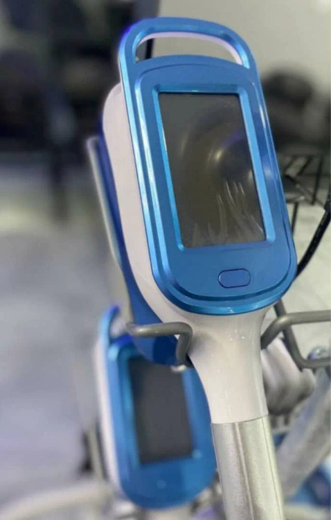 کرایو لیپولیز ۳۶۰