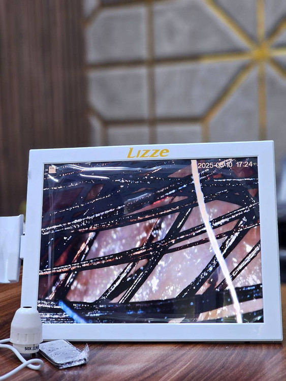 دستگاه آنالیزور پوست و مو لیز